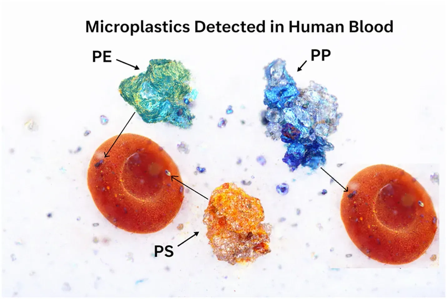 Representative image showing microplastics detected in human blood (PEâpolyethylene; PPâpolypropylene; PSâpolystyrene)